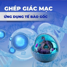 Ghép giác mạc - Ứng dụng tế bào gốc